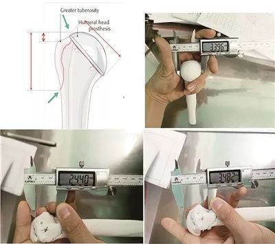 VA 3D printing proves more useful for shoulder-surgery planning than current visualization methods